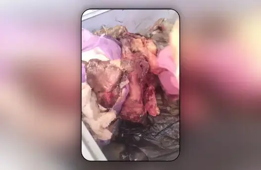 حجز لحوم فاسدة