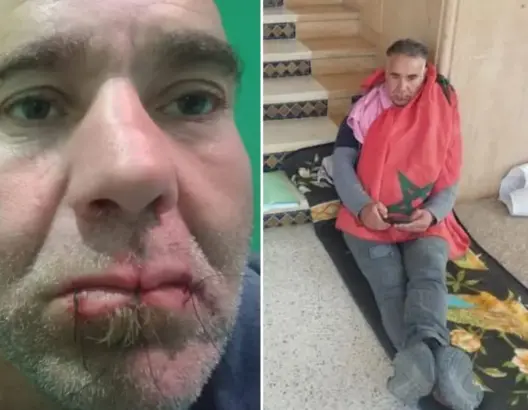 حارس مقبرة بسيدي قاسم يخيط فمه احتجاجا على عدم تنفيذ حكم قضائي