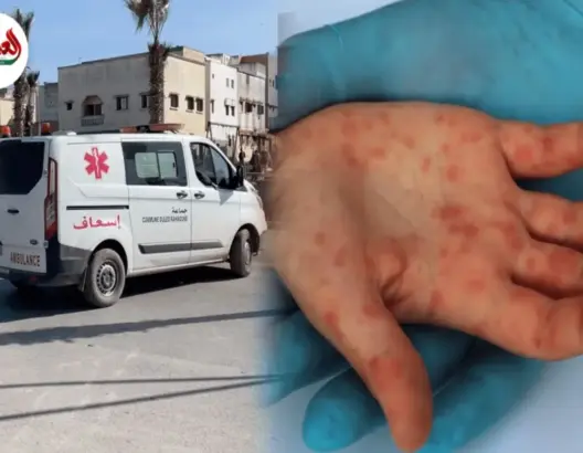 “بوحمرون”.. مطالب بكشف ملابسات وفاة سيدة بالجديدة