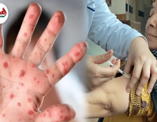 انطلاق التلقيح ضد “بوحمرون” بأزمور