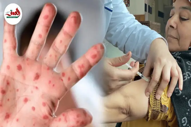 عضو اللجنة العلمية للتلقيح: التطعيم ضد داء بوحمرون آمن وفعال (فيديو)