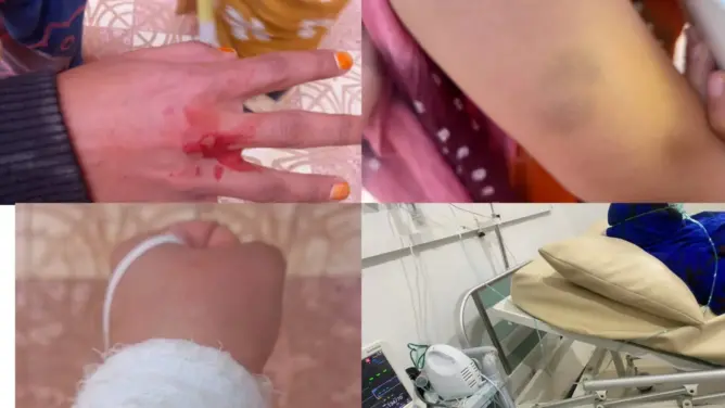 تحالف حقوقي يستنكر تعنيف طالبات صحراويات في مؤسسة تعليمية جزائرية (صور)