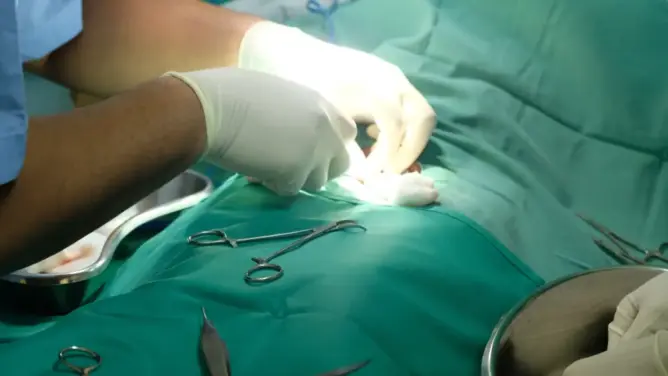 عمليات ختان بـ20 مليون بمقاطعة سيدي مومن تثير مخاوف “التوظيف الانتخابي”