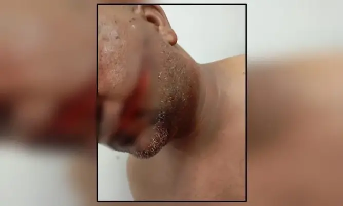 طعنة غادرة تُشوّه وجه بائع فواكه بخريبكة.. ومطالب مهنية بمحاصرة حاملي السلاح الأبيض