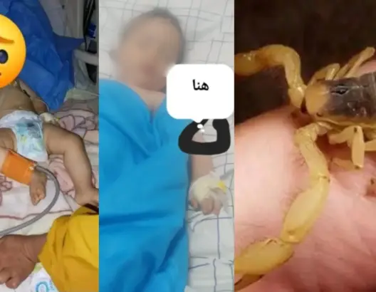 وفاة طفل في ربيعه الأول بلدغة عقرب نواحي ورزازات
