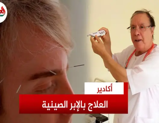أسرار العلاج بالإبر الصينية ومخاطر الحجامة العشوائية