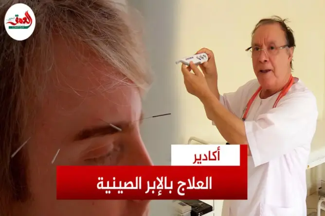 أسرار العلاج بالإبر الصينية ومخاطر الحجامة العشوائية