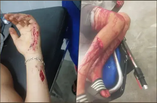 هجوم دموي يثير الرعب بحي سيدي موسى بالجديدة