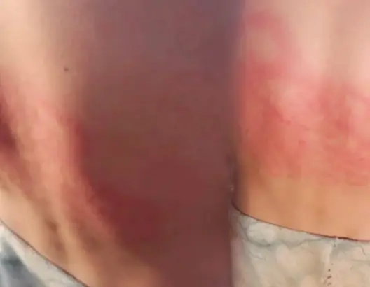 اعتداء جسدي على راعي أغنام يثير غضبا بأزيلال ويستنفر حقوقيين (صور)