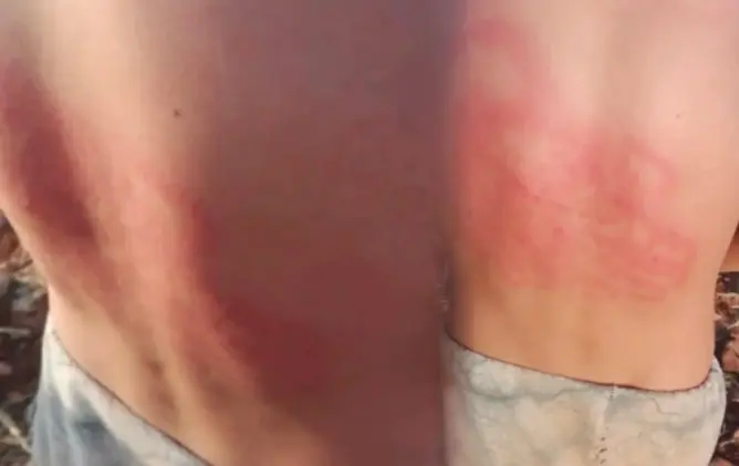 اعتداء جسدي على راعي أغنام يثير غضبا بأزيلال ويستنفر حقوقيين (صور)