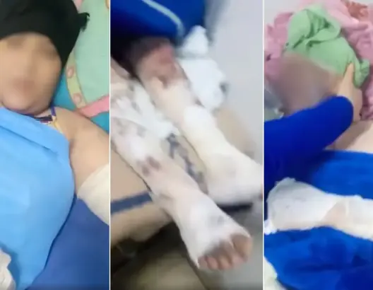 التهراوي يتفقد ضحايا انفجار “بوطة” بأزرو ويأمر بالتحقيق في شبهات الإهمال