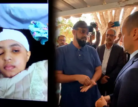 سبعة أشهر من الانتظار.. الطفلة نعمة بين ألم الإهمال الطبي ووعد وزير الصحة المعلق (فيديو)