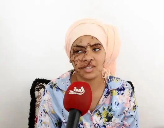 قضية إيمان تصل البرلمان وتعيد النقاش حول تزويج الضحايا من مغتصبيهم