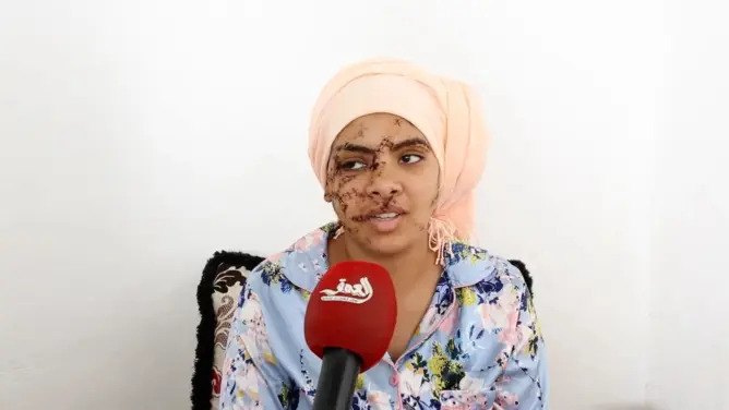 قضية إيمان تصل البرلمان وتعيد النقاش حول تزويج الضحايا من مغتصبيهم