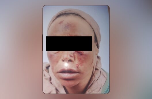 شكاية أمام وكيل الملك بخصوص اعتداء جسدي ولفظي على سيدة بمدينة تيفلت