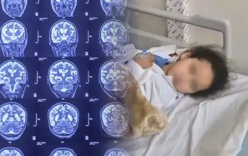 مرض نادر يهدد حياة الطفلة “تسنيم” .. تعاطف واسع ودعوات للوزارة بالتكفل بحالتها
