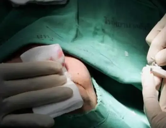 تشميع مصحة تجميل “سرية” بمراكش وإيداع مسيرها السجن في ملف “الأطباء المزيفين”