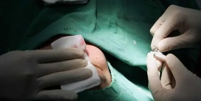 تشميع مصحة تجميل “سرية” بمراكش وإيداع مسيرها السجن في ملف “الأطباء المزيفين”