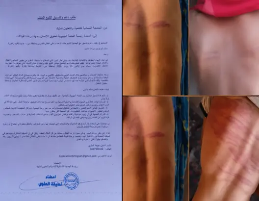 ملف قاصري زاكورة يستنفر جمعية نسائية للمطالبة بتدخل اللجنة الجهوية لحقوق الإنسان