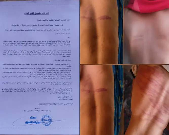 ملف قاصري زاكورة يستنفر جمعية نسائية للمطالبة بتدخل اللجنة الجهوية لحقوق الإنسان