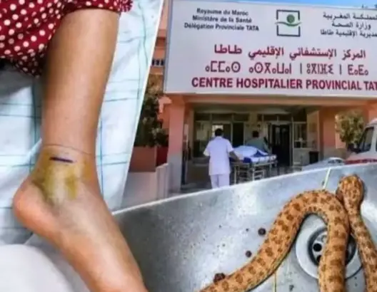 الباز تسائل وزير الصحة عن نفاد أمصال لدغات الأفاعي بطاطا بعد وفاة سيدة