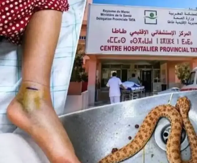 الباز تسائل وزير الصحة عن نفاد أمصال لدغات الأفاعي بطاطا بعد وفاة سيدة
